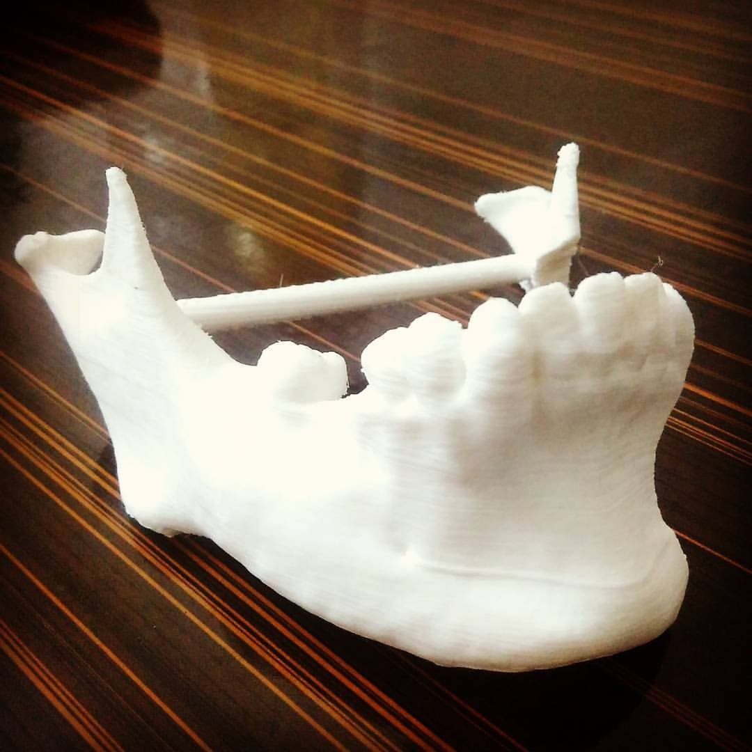 jaw-model